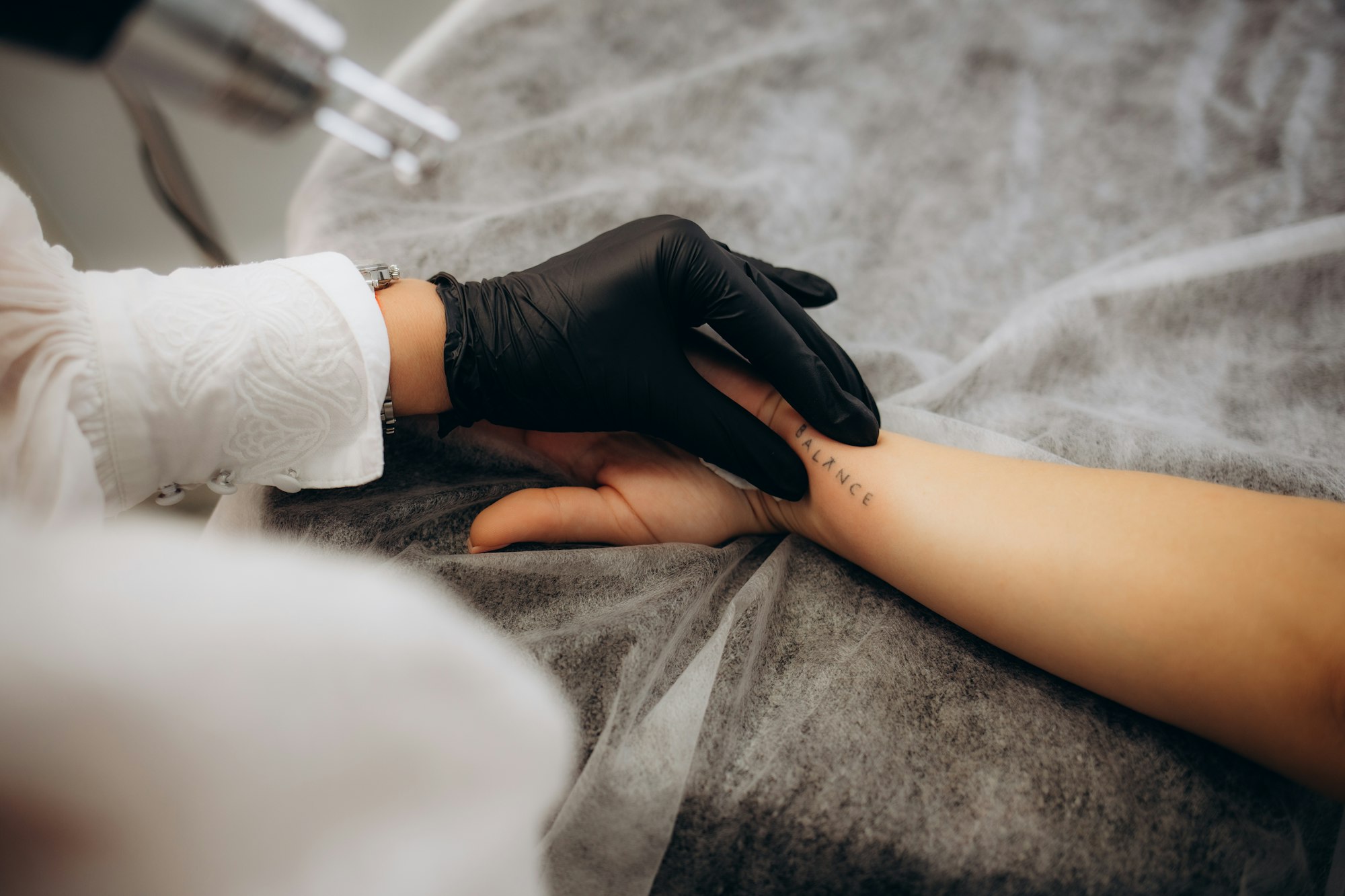 Behandlung eines Tattoos am Unterarm mit dem Laser