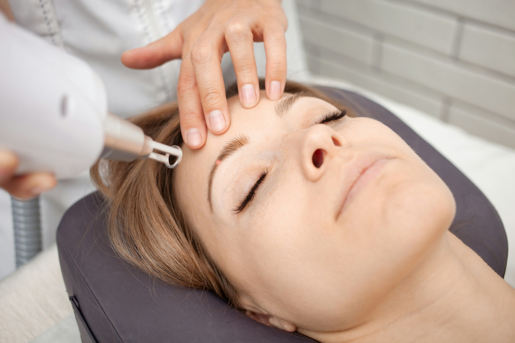 Laserbehandlung zur Entfernung von Permanent-Make-up an der Augenbraue