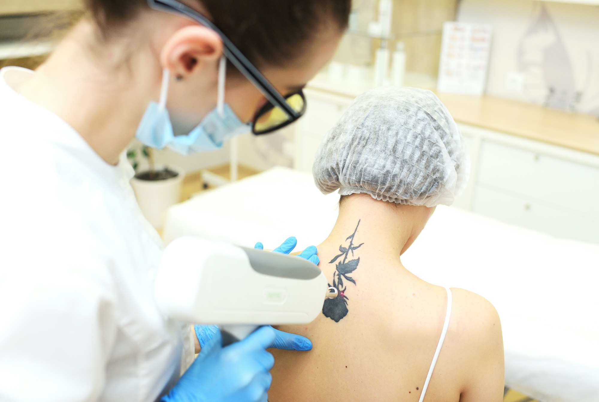Handstück des Pico-Lasers direkt über einem Tattoo