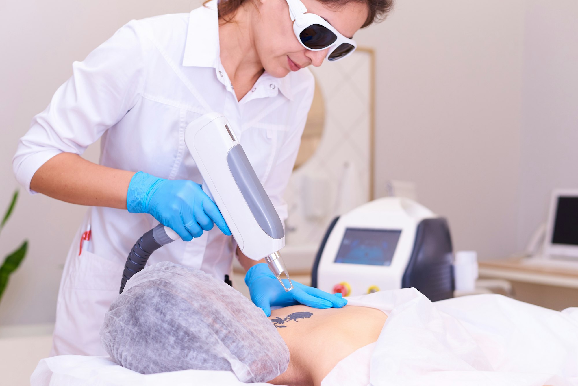 Laserbehandlung eines farbigen Tattoos im Behandlungsraum